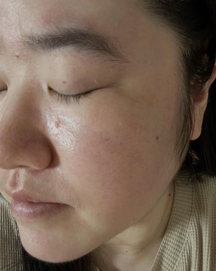 サミュ ガラクトポア オーツートナー/SAM'U/化粧水を使ったクチコミ(9枚目)