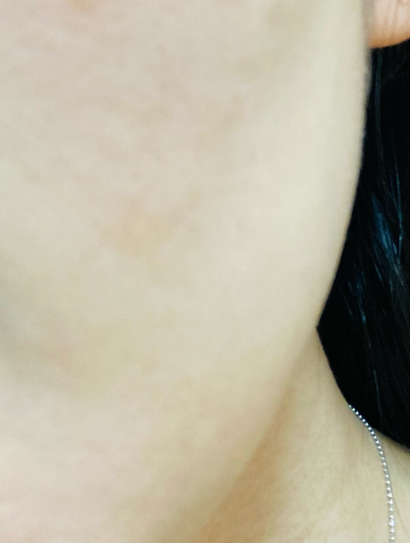 C×AZ ダーマインショット200/ESIENCE/美容液を使ったクチコミ(7枚目)