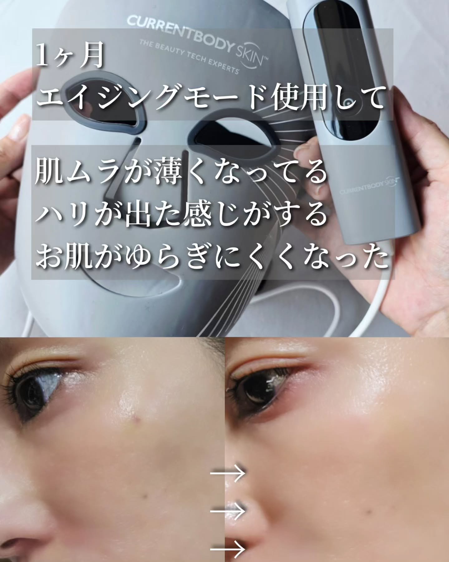 LEDライトセラピーマスク シリーズ2/CurrentBody/美顔器・マッサージを使ったクチコミ（2枚目）