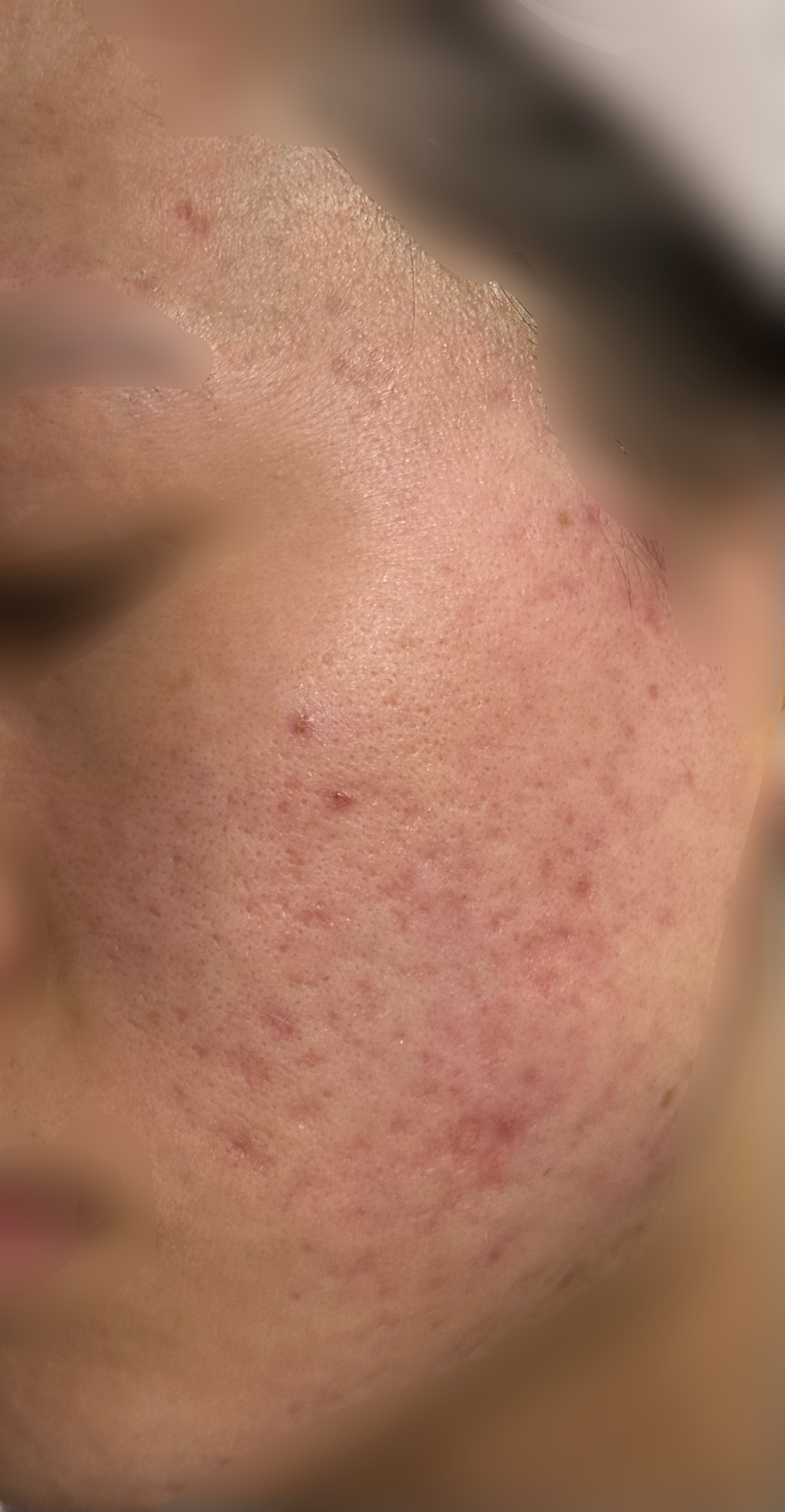 コラージュフルフルホイップソープ /コラージュ/泡洗顔を使ったクチコミ（2枚目）