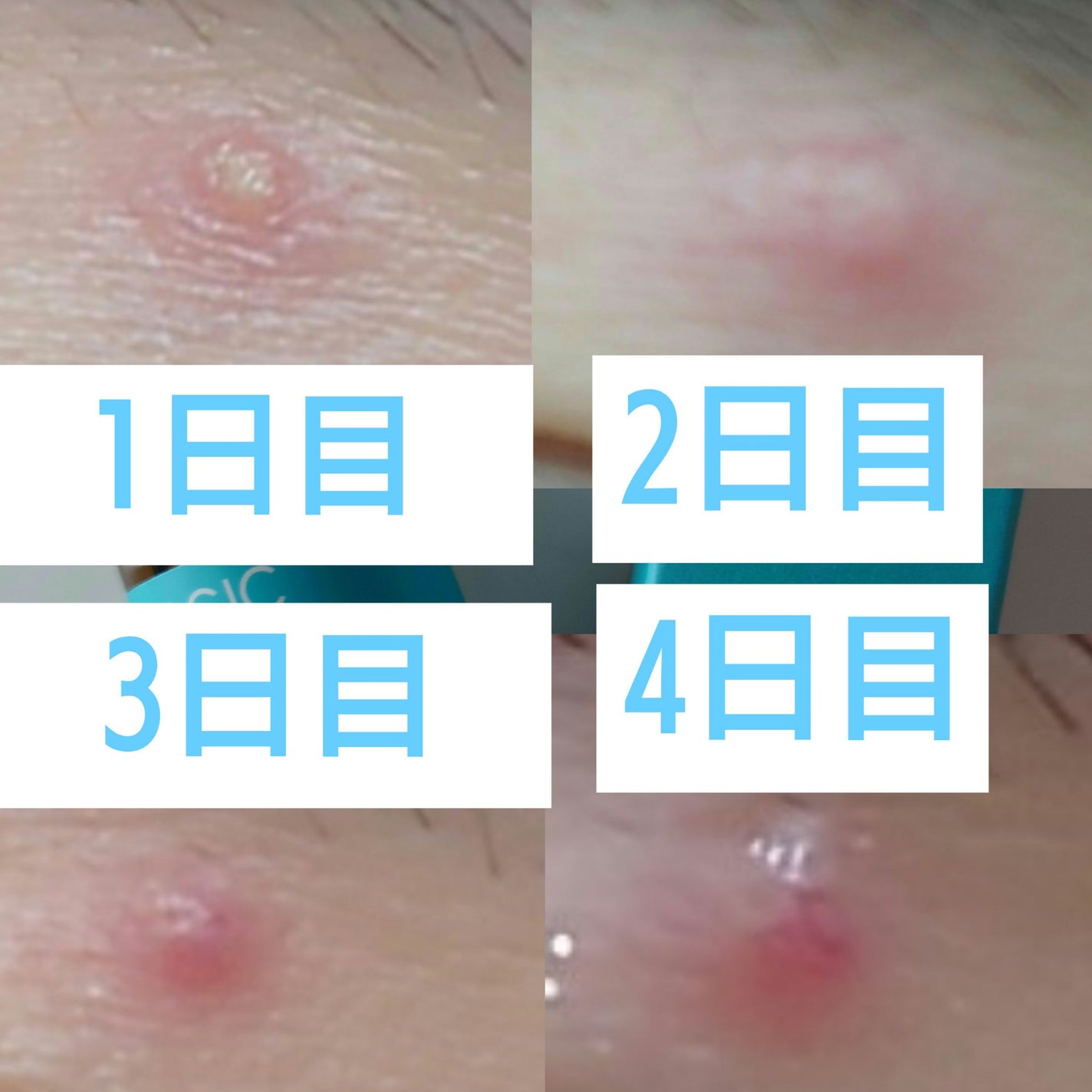 マジックティーツリーオイル/ブラン/フェイスオイルを使ったクチコミ(3枚目)