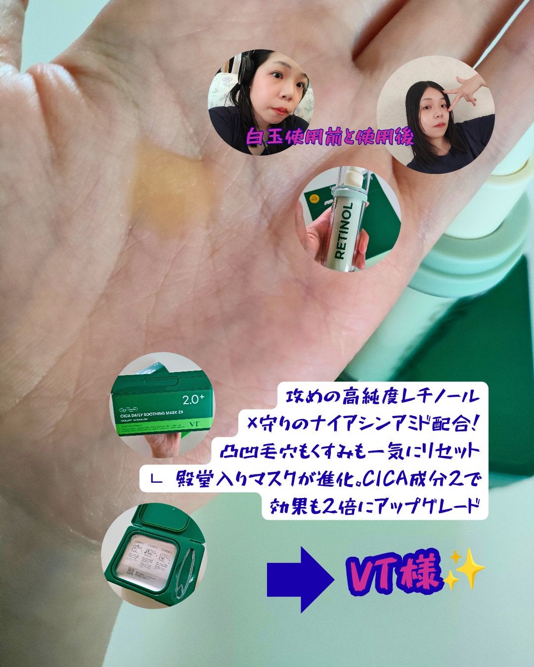CICA デイリースージングマスク/VT/シートマスク・パックを使ったクチコミ(1枚目)