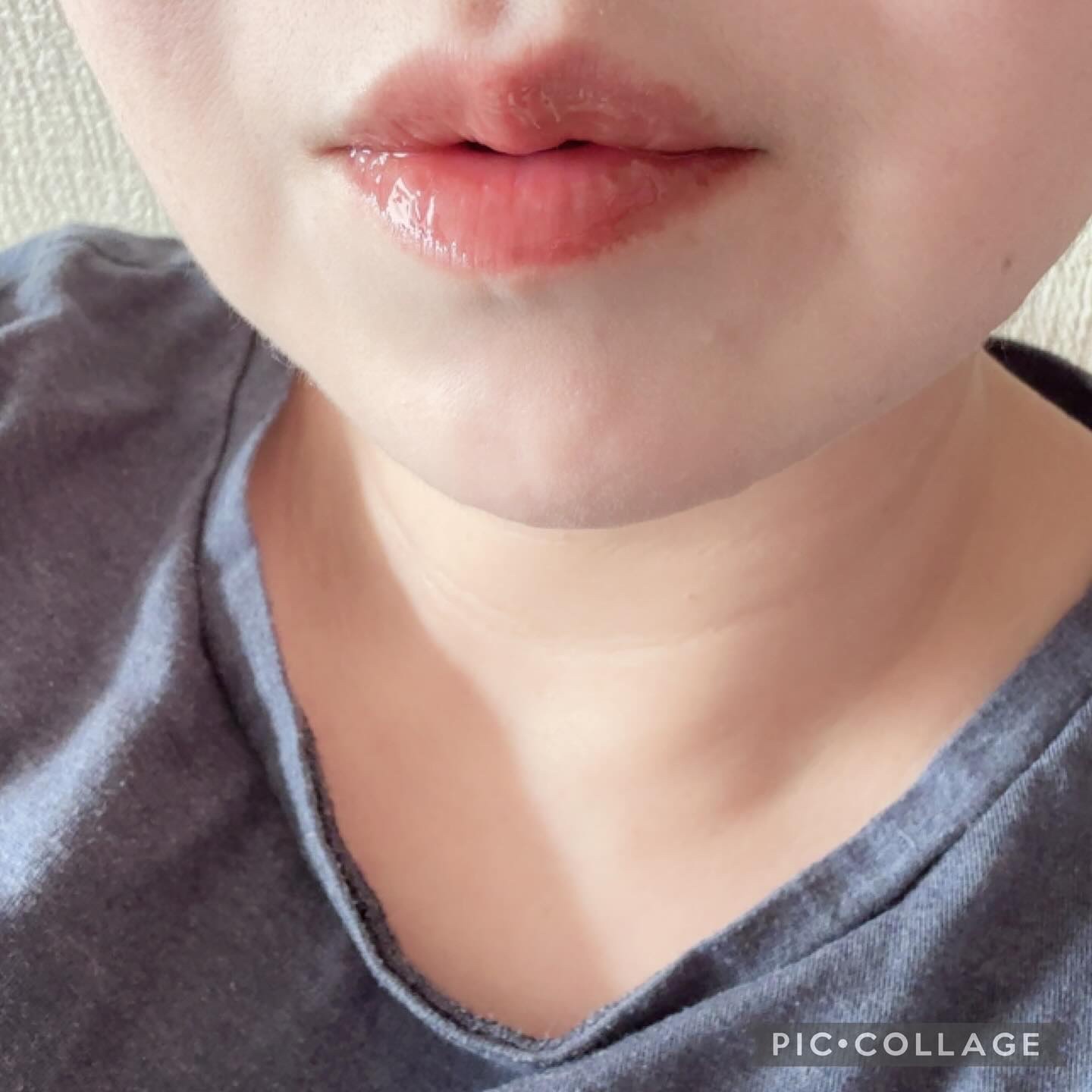 PDRNショット リッププランパー/fractionalCC/リッププランパーを使ったクチコミ（3枚目）