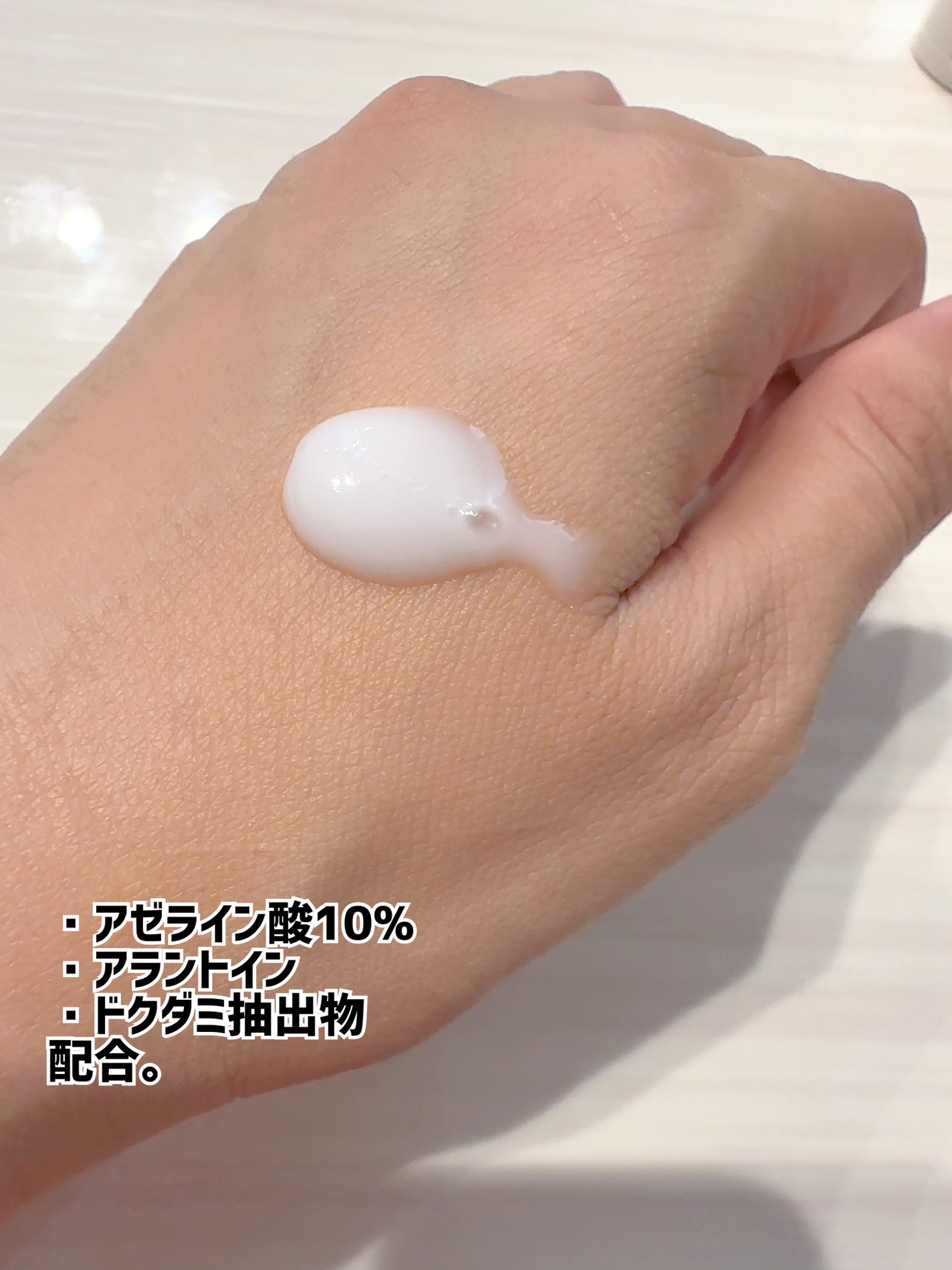 EIOM アクネクスクリーム/EIOM/フェイスクリームを使ったクチコミ(2枚目)