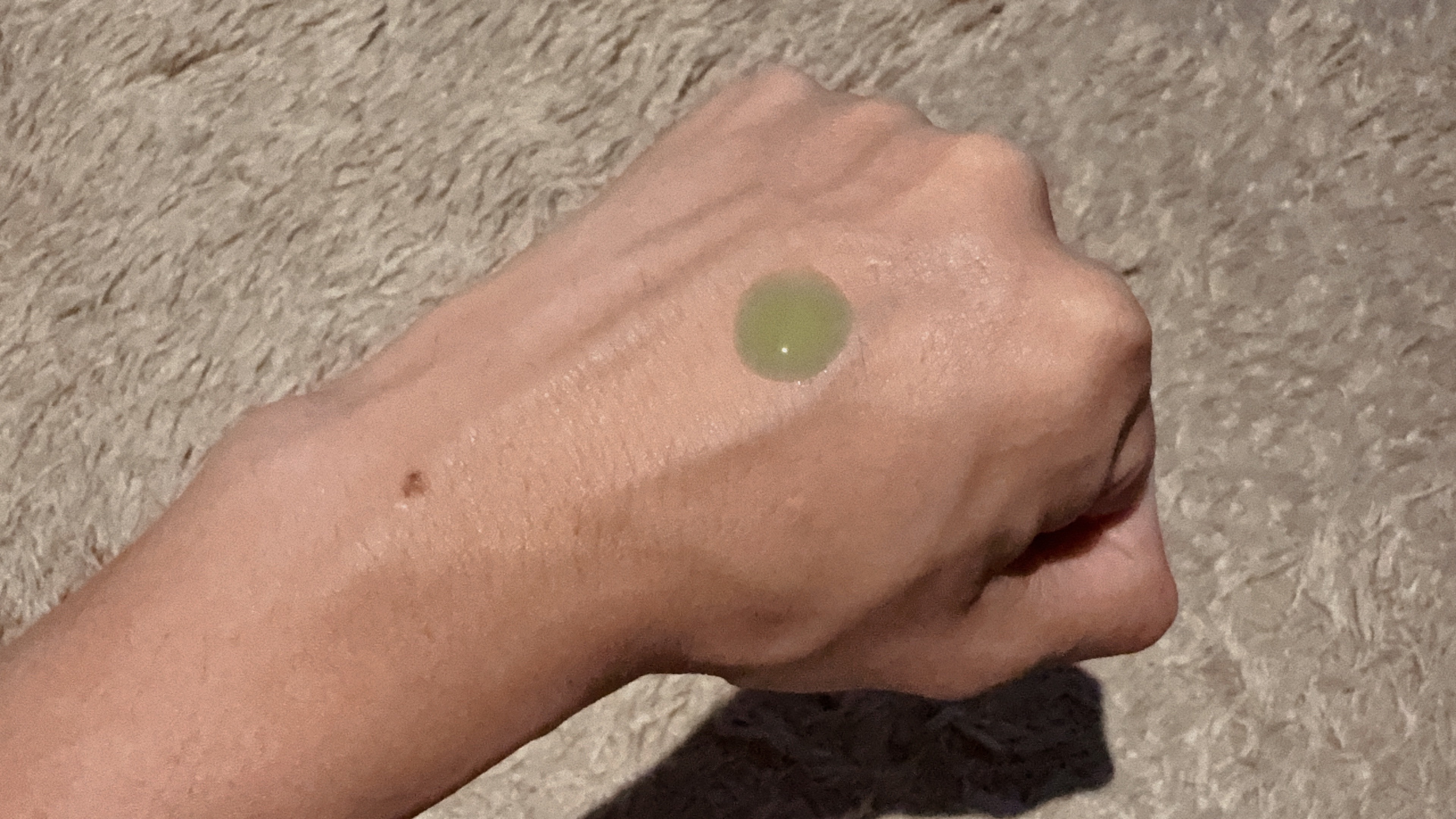 アゼライン酸ゴマージュピーリングセラム/Dr.Melaxin/美容液を使ったクチコミ（3枚目）