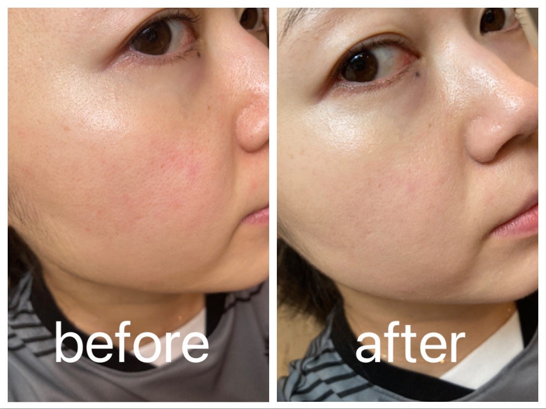 KC SKIN モイストリペアセラムマスク/KC SKIN – Kristen Claire/シートマスク・パックを使ったクチコミ(5枚目)