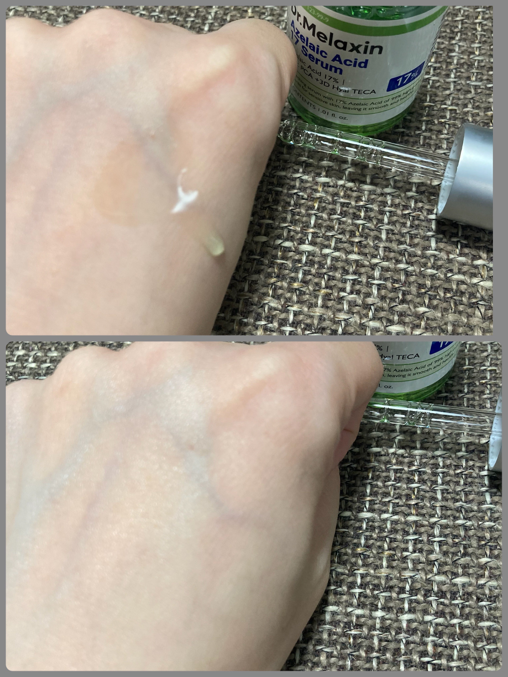 アゼライン酸ゴマージュピーリングセラム/Dr.Melaxin/美容液を使ったクチコミ（3枚目）