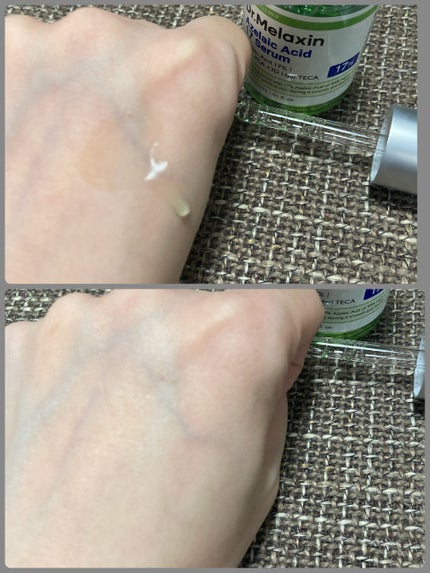 アゼライン酸ゴマージュピーリングセラム/Dr.Melaxin/美容液を使ったクチコミ(3枚目)