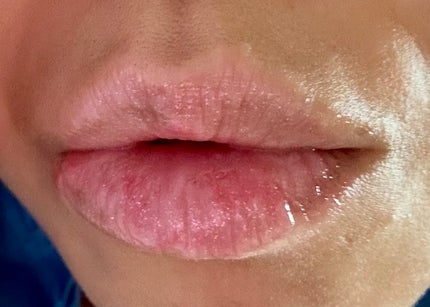 エッセンス リッププランパー SP002 オーロラピンク(限定)/Visée/リッププランパーの画像