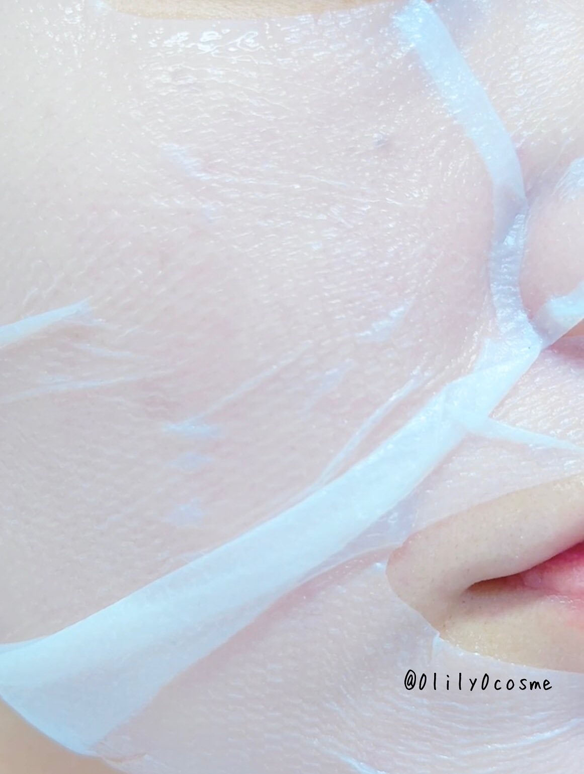 トラブルパッチマスク/EIOM/その他スキンケアを使ったクチコミ(7枚目)