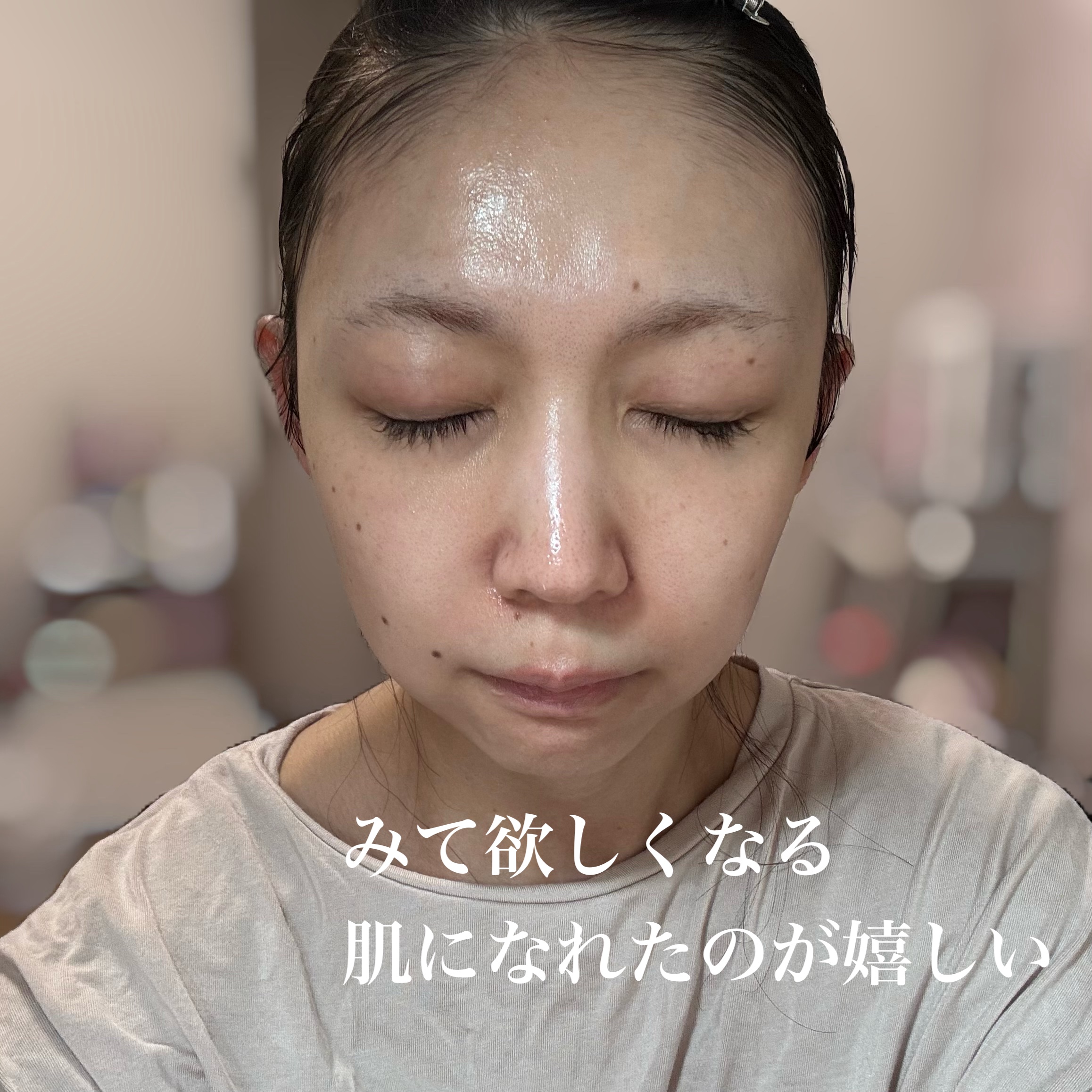 オイデルミン エッセンスローション/SHISEIDO/化粧水を使ったクチコミ（3枚目）