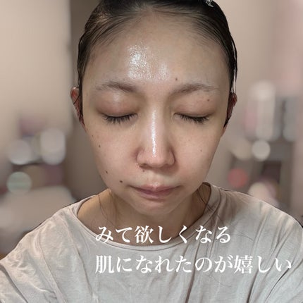 オイデルミン エッセンスローション/SHISEIDO/化粧水を使ったクチコミ(3枚目)