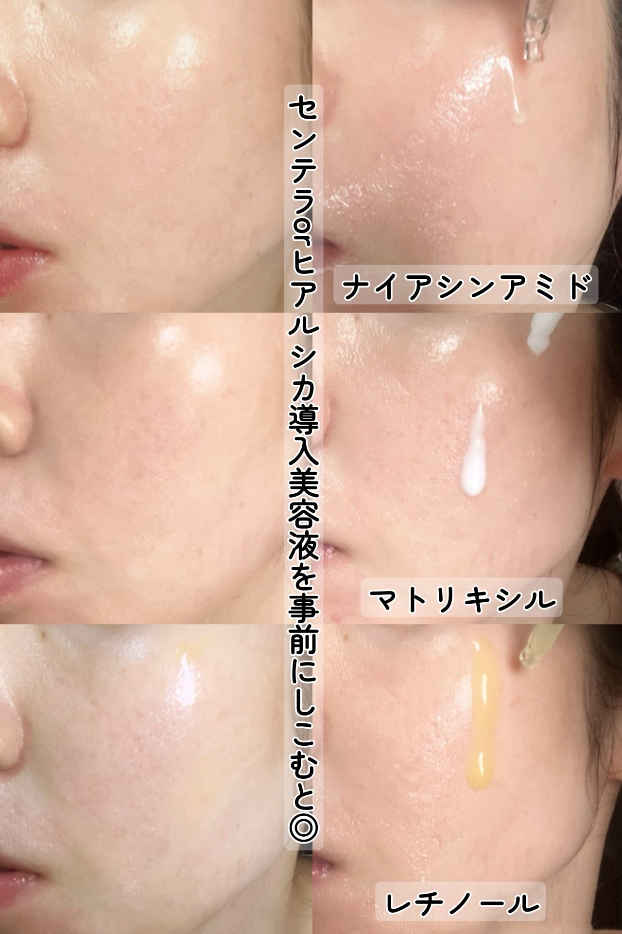 レチノール 0.2 ブースティングショット アンプル/SKIN1004/美容液を使ったクチコミ(3枚目)