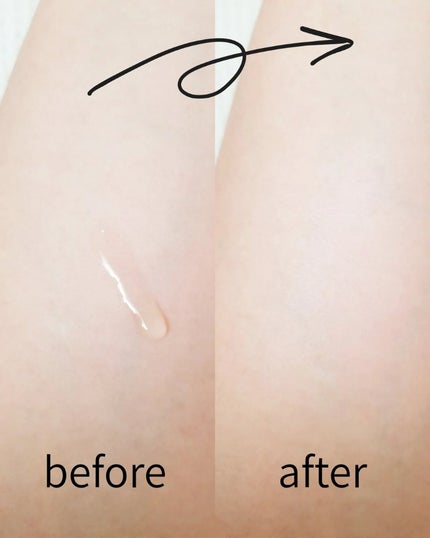 ãã¢ã¿ã€ããã³ã°ã¢ã³ãã« /REJURAN COSMETICS/çŸå®¹æ¶²ã䜿ã£ãã¯ãã³ãïŒ3æç®ïŒ