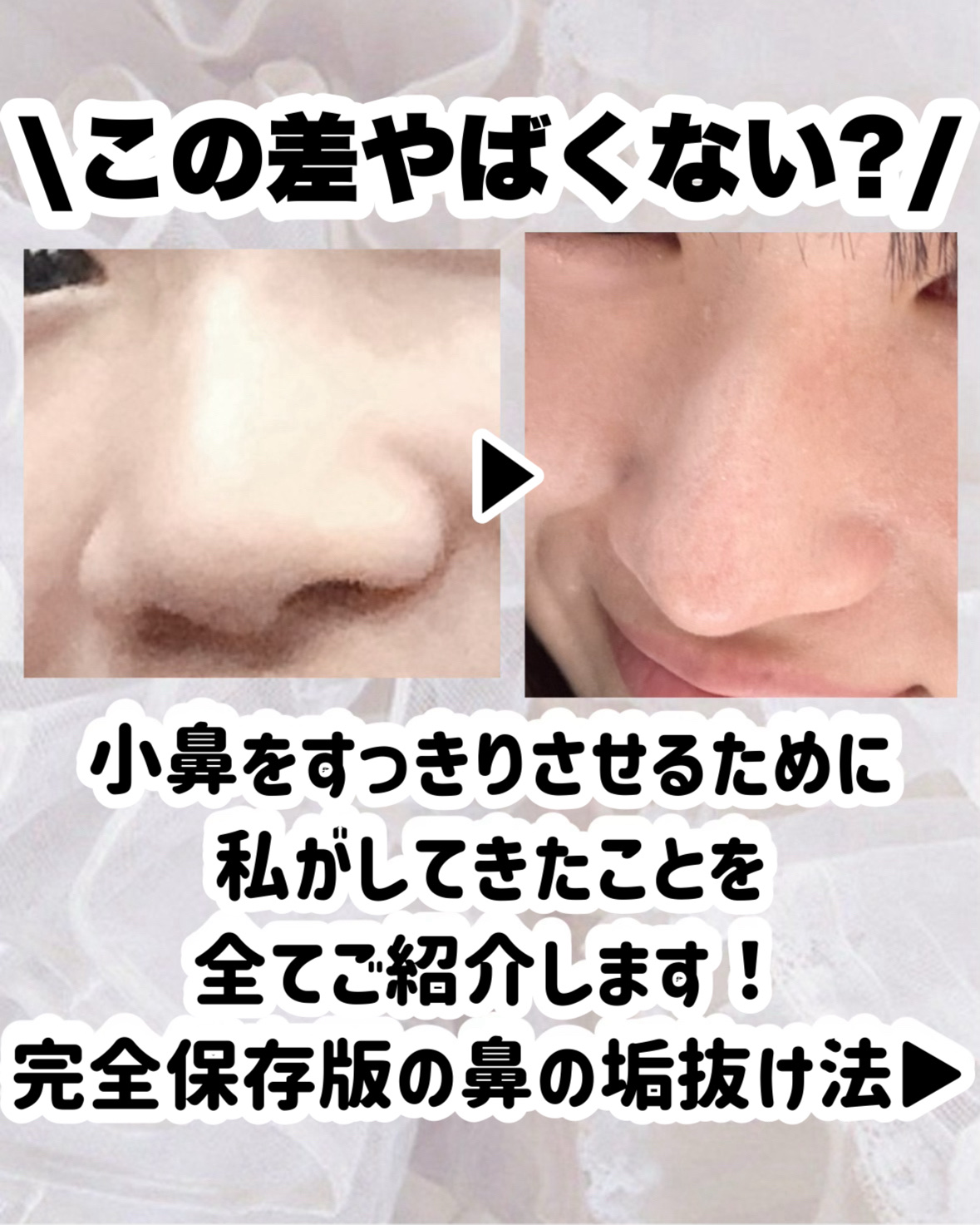 ハトムギ保湿ジェル(ナチュリエ スキンコンディショニングジェル)/ナチュリエ/美容液を使ったクチコミ（2枚目）