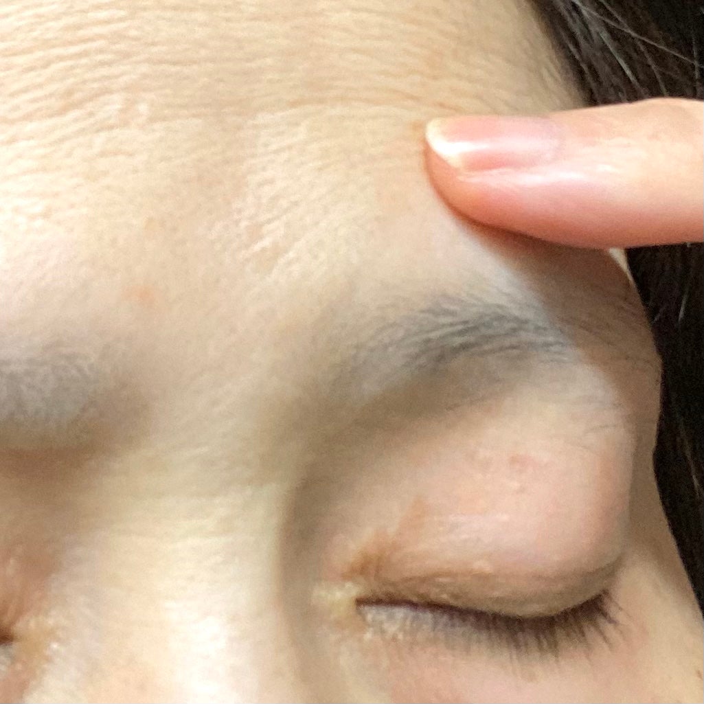 アクネスラボ 相澤メソッド 薬用ミドリクリーム/HIN アクネスラボ/フェイスクリームを使ったクチコミ(5枚目)