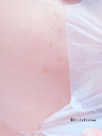 トラブルパッチマスク/EIOM/その他スキンケアを使ったクチコミ(8枚目)