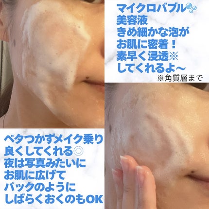 PDRN ヒアルロン酸 ミントマイクロバブルセラム/VT/美容液を使ったクチコミ(2枚目)