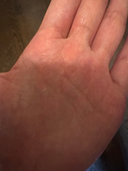 PDRNヒアルロン酸カプセル100セラム/Anua/美容液を使ったクチコミ(2枚目)