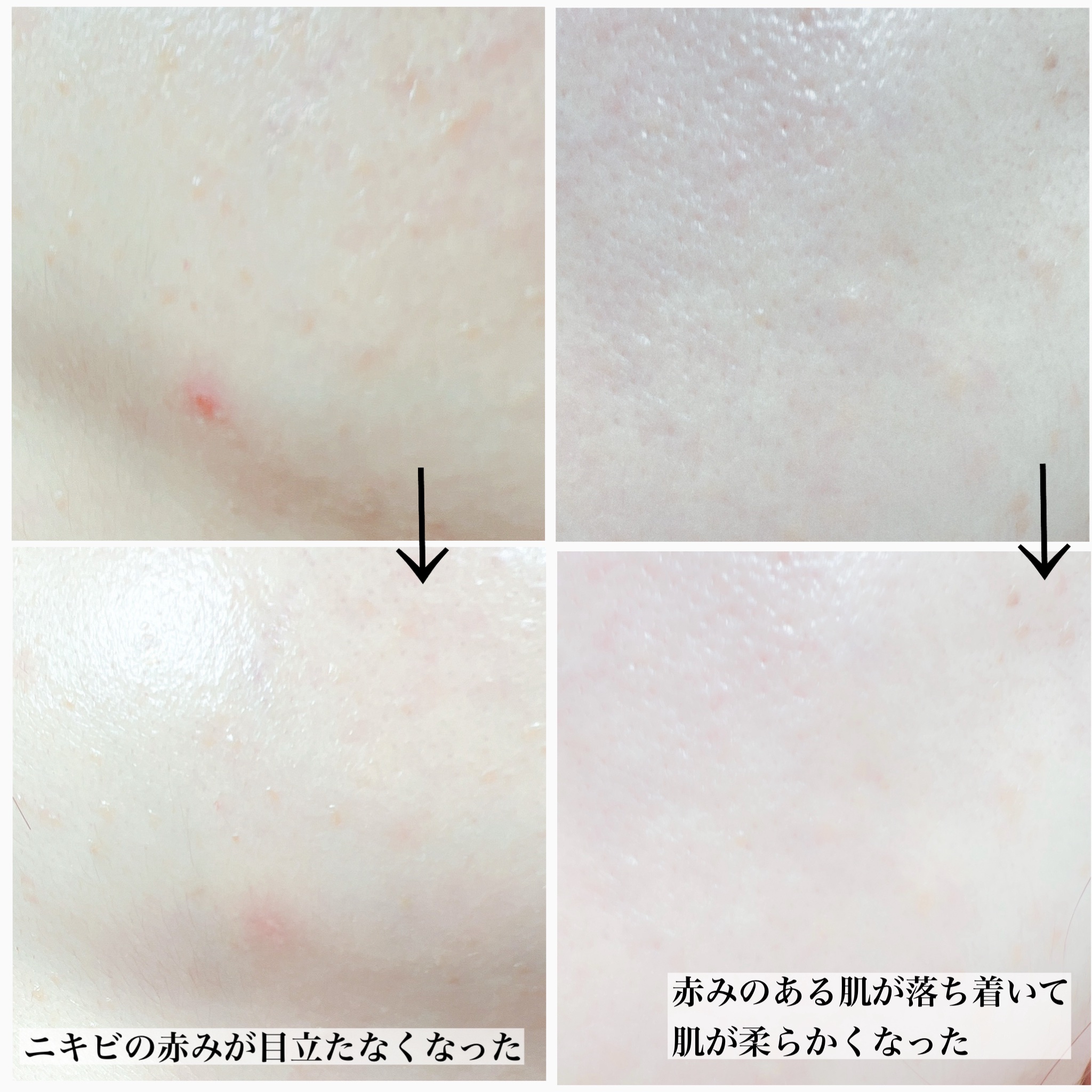 ヴィーガンAHA PHA アンプル/ureun/美容液を使ったクチコミ（3枚目）