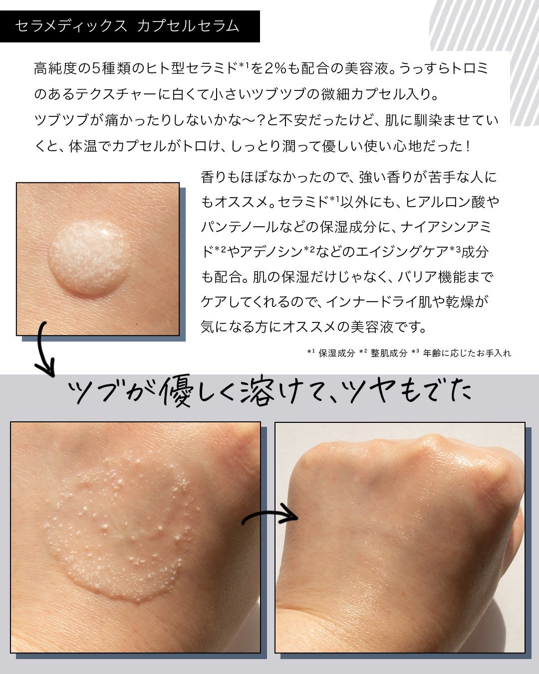 コスザッカ on LIPS 「\インナードライ肌の保湿&バリア機能ケア♪/エステやスパ、化粧..」(4枚目)