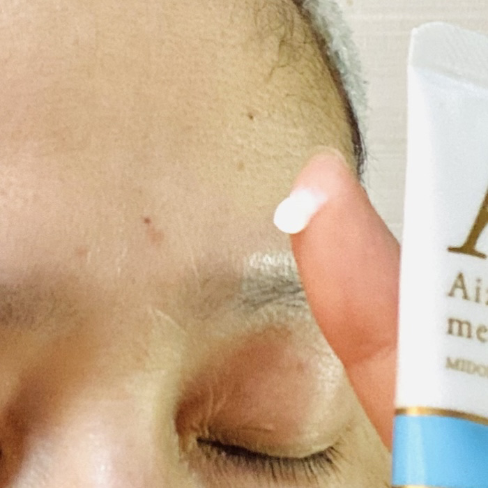 アクネスラボ 相澤メソッド 薬用ミドリクリーム/HIN アクネスラボ/フェイスクリームを使ったクチコミ（3枚目）