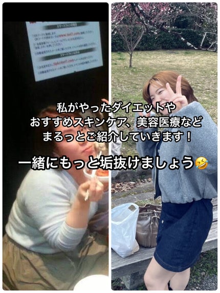 まいち on LIPS 「私の垢抜け記録✏️𓈒𓏸⑅︎┈┈┈┈┈⑅︎𓏸𓈒┈┈┈┈┈⑅︎𓏸𓈒..」(4枚目)