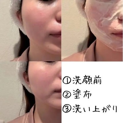 米PDRNマスククレンザー/FULLY/洗顔フォームを使ったクチコミ(3枚目)