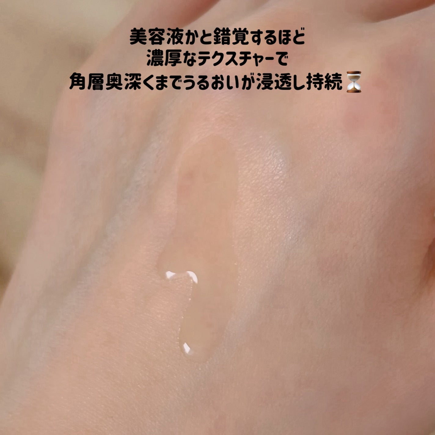 オイデルミン エッセンスローション/SHISEIDO/化粧水を使ったクチコミ(6枚目)