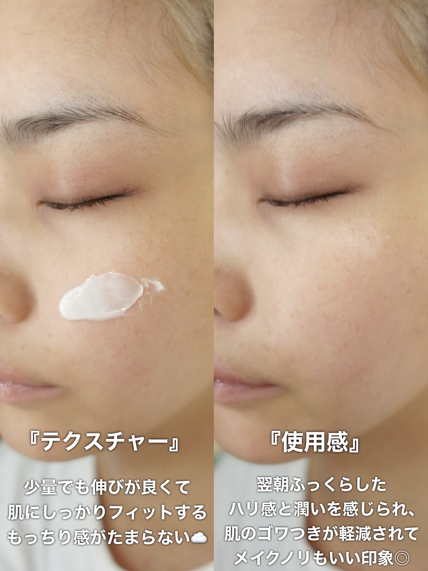 エキスパートマデカアクティブリニューPDRN/センテリアン24/フェイスクリームを使ったクチコミ（3枚目）