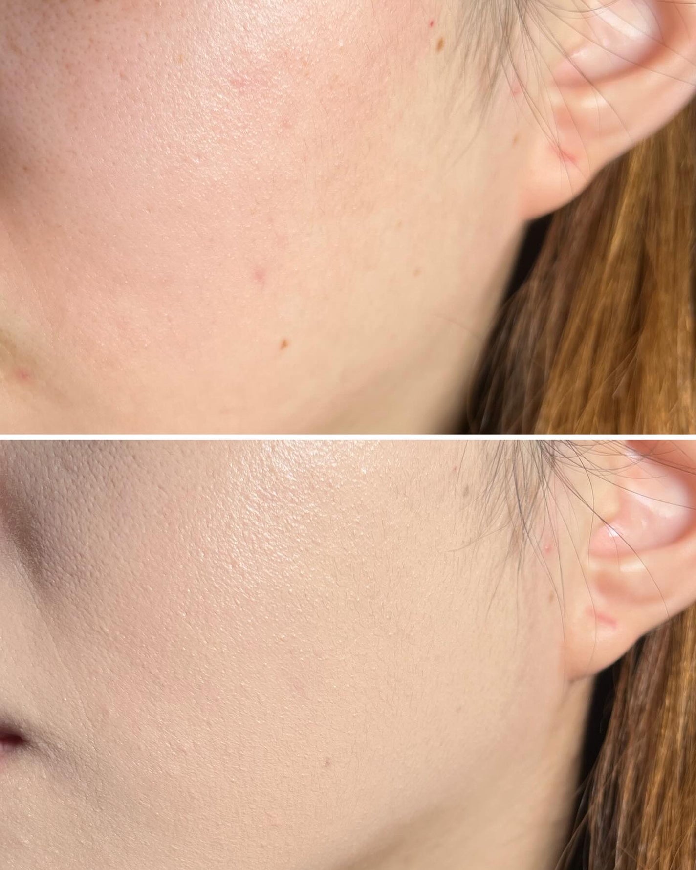 スキンレイヤーフィットファンデーション/ABOUT TONE/リキッドファンデーションを使ったクチコミ(4枚目)