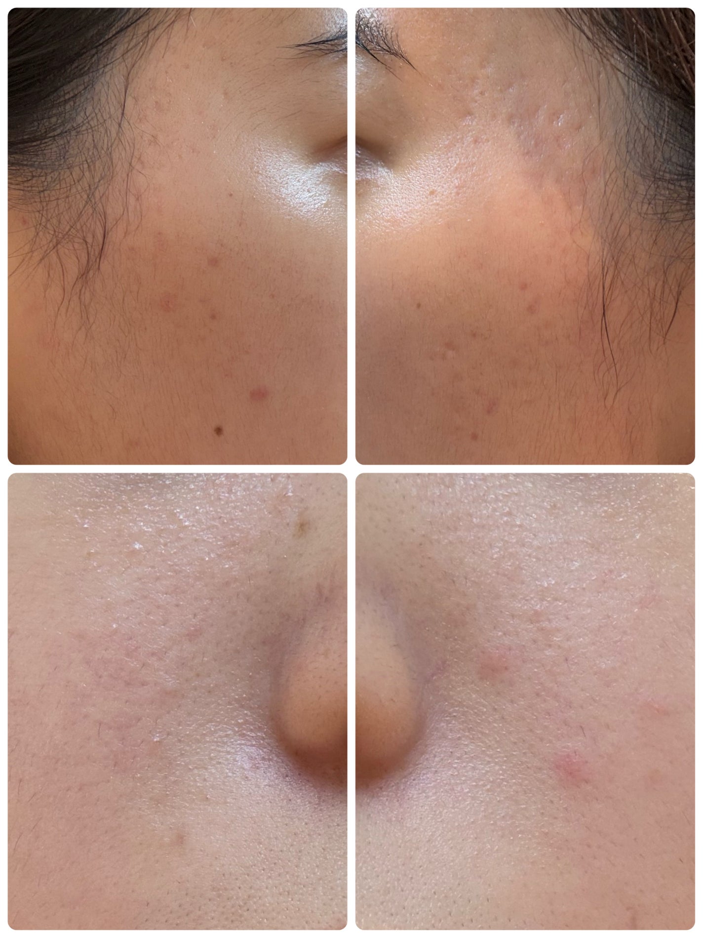 モーニングジェルウォッシュ/ビトレスキン/その他洗顔料を使ったクチコミ(2枚目)