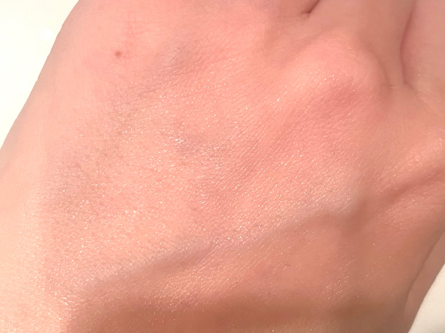 エファクラ ピールケア セラム/ラ ロッシュ ポゼ/美容液を使ったクチコミ(3枚目)