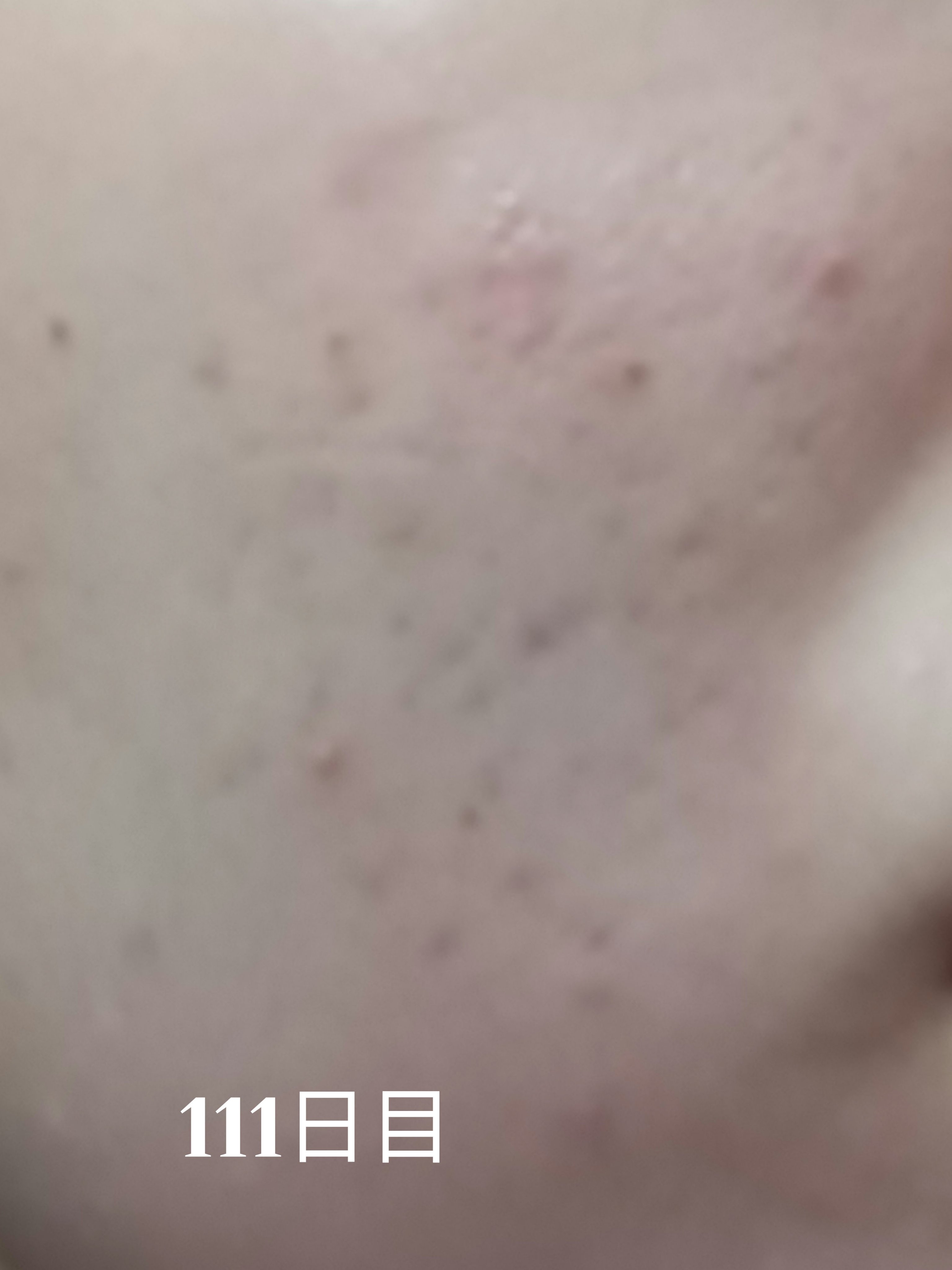 CUREPAIR DERMA AMPOULE /KOPHER/ミスト状化粧水を使ったクチコミ（1枚目）