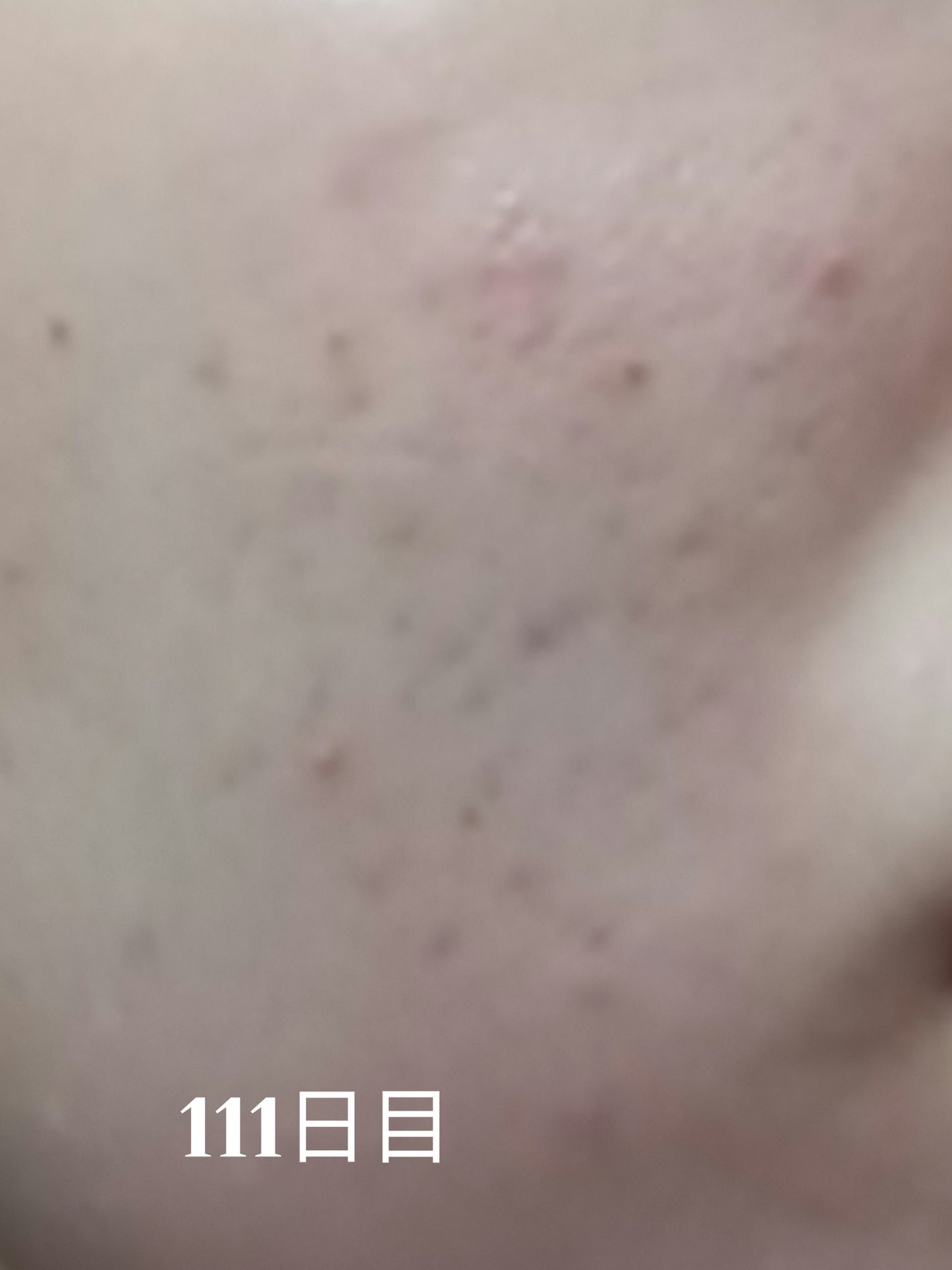 CUREPAIR DERMA AMPOULE /KOPHER/ミスト状化粧水を使ったクチコミ(1枚目)