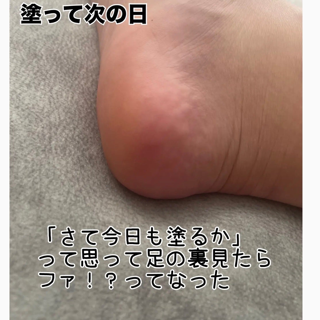 まる子✳︎共働き主婦 on LIPS 「え、まじで1日目で白線消えて2日目には硬い感じも消滅したんだが..」(2枚目)