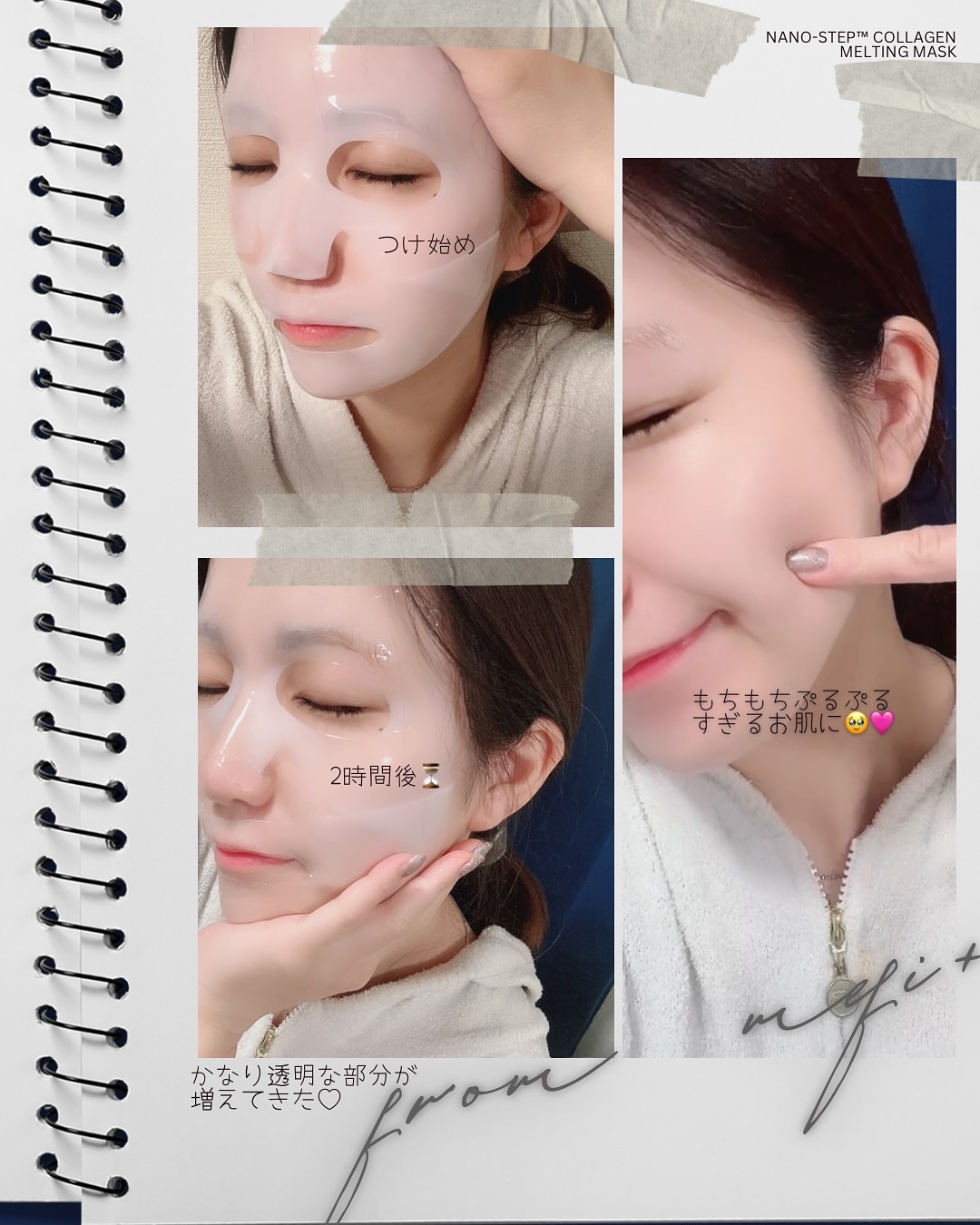 ナノステップ コラーゲン メルティングマスク/from medi+/シートマスク・パックを使ったクチコミ（3枚目）