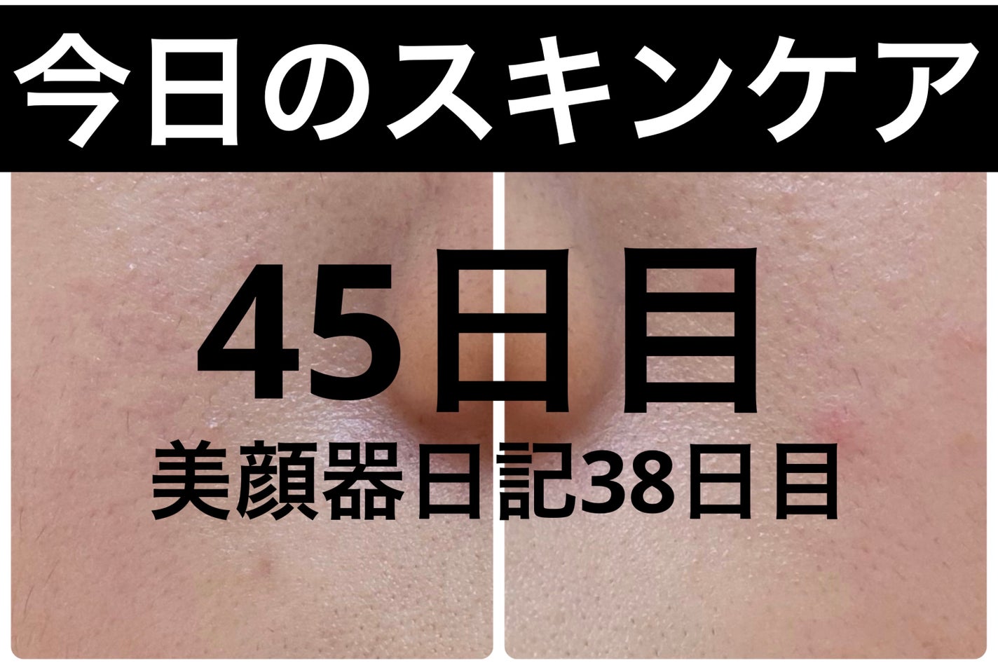 モーニングジェルウォッシュ/ビトレスキン/その他洗顔料を使ったクチコミ(1枚目)