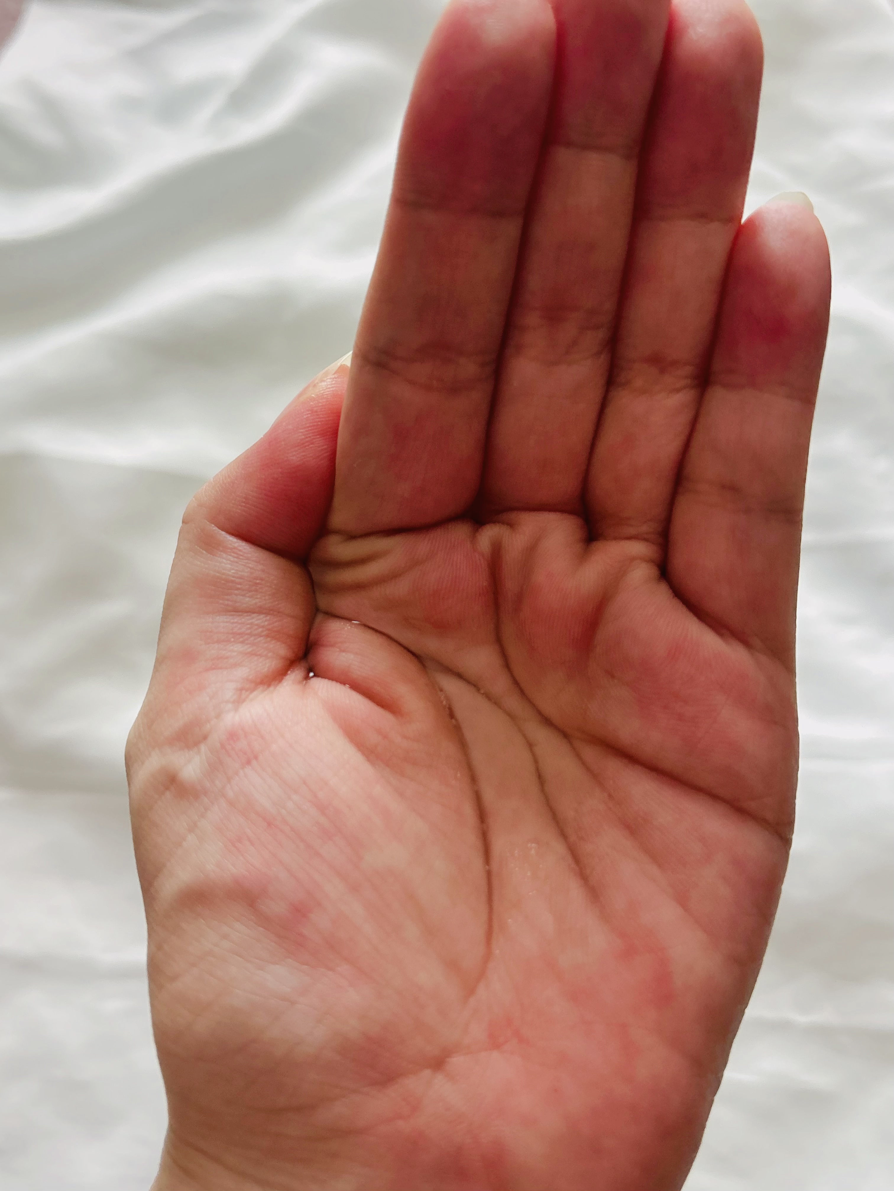 ネイチャーコンク 薬用クリアローション/ネイチャーコンク/拭き取り化粧水を使ったクチコミ（2枚目）