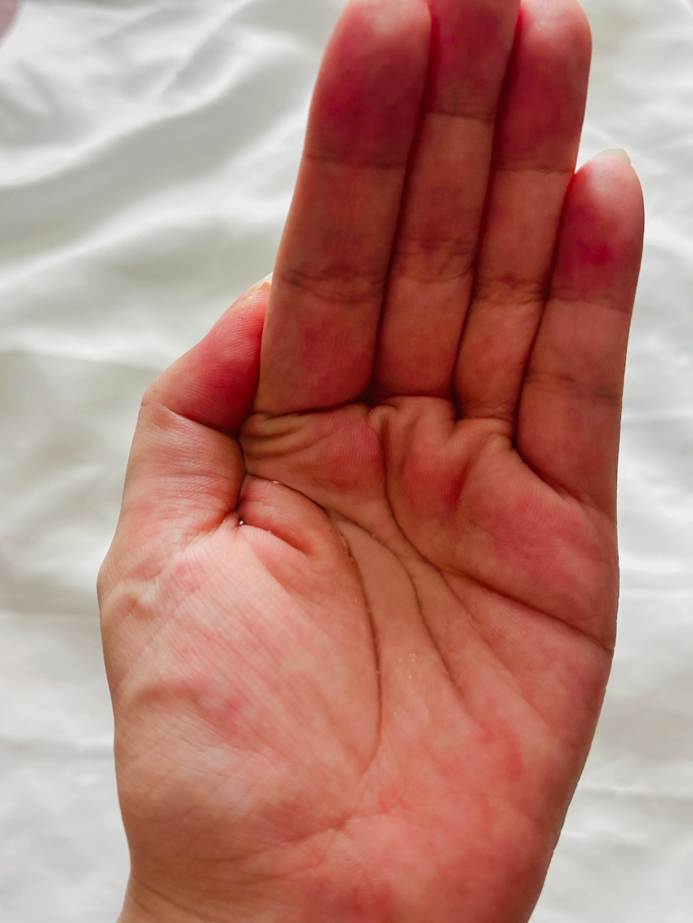 ãã€ãã£ãŒã³ã³ã¯ è¬çšã¯ãªã¢ããŒã·ã§ã³/ãã€ãã£ãŒã³ã³ã¯/æãåãåç²§æ°Žã䜿ã£ãã¯ãã³ãïŒ2æç®ïŒ