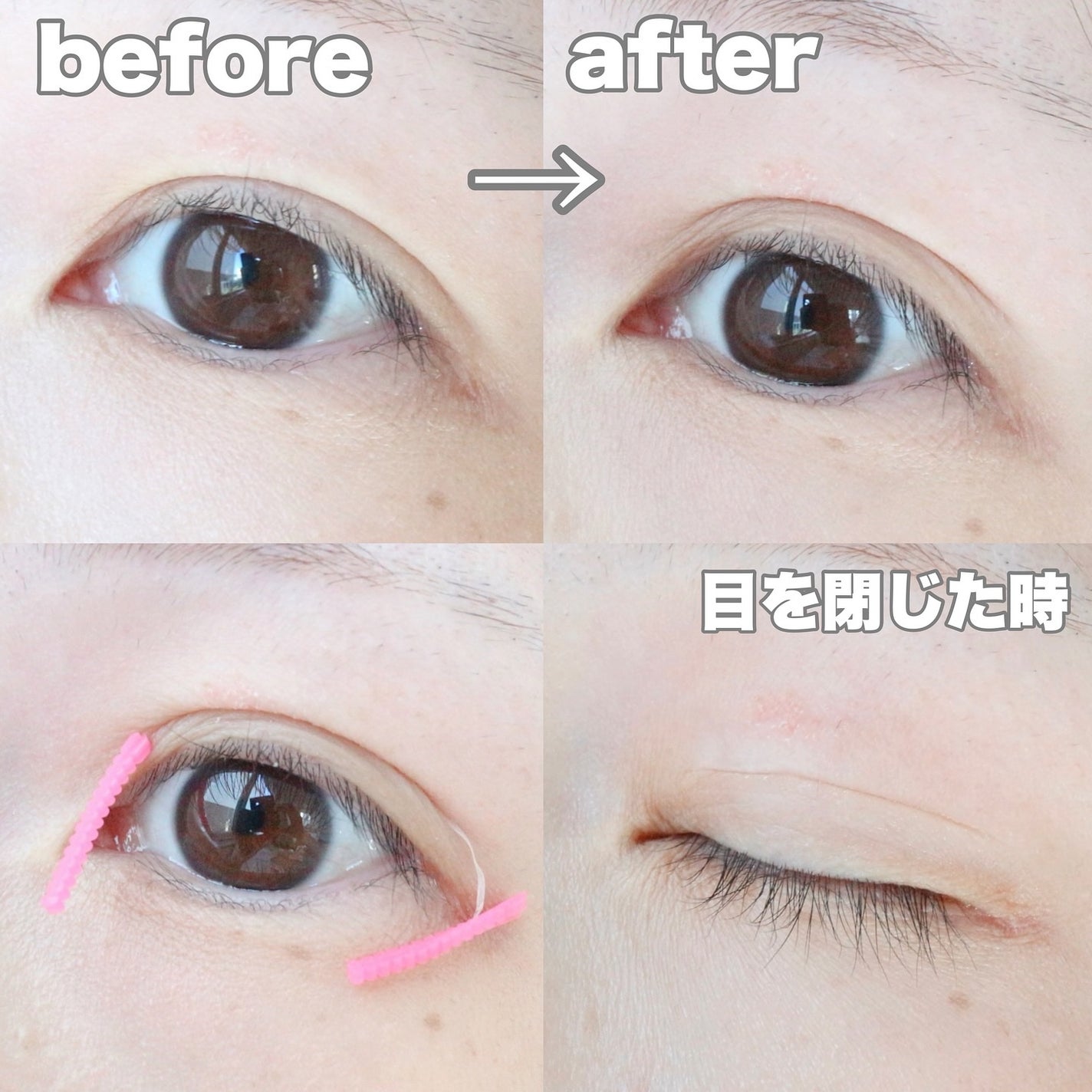 メザイク クリップ カッター ファイバー専用カッター/メザイク/二重まぶた用アイテムを使ったクチコミ(9枚目)