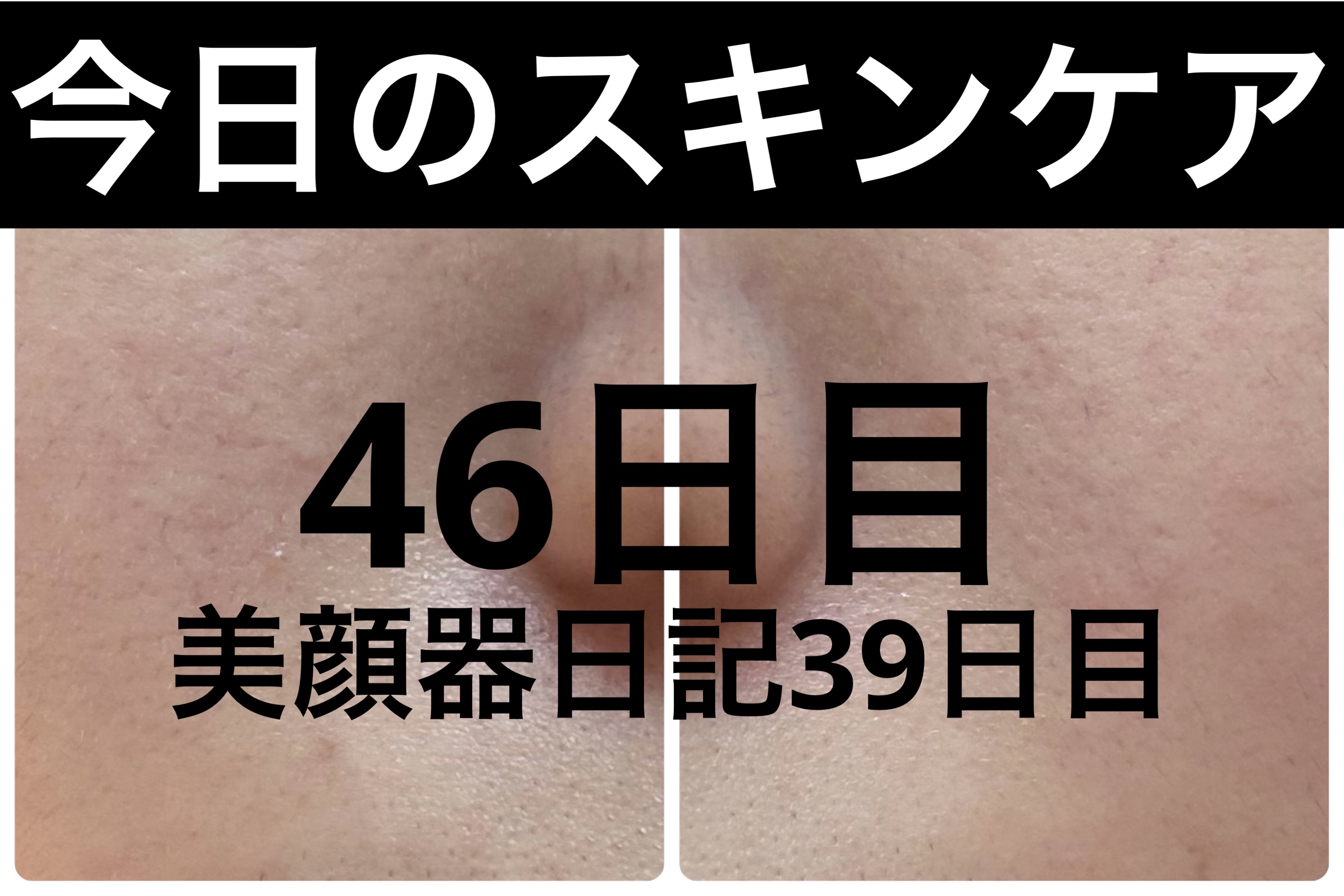 薬用雪肌精 ブライトニング クレンジング オイル[医薬部外品]/雪肌精/オイルクレンジングを使ったクチコミ（1枚目）