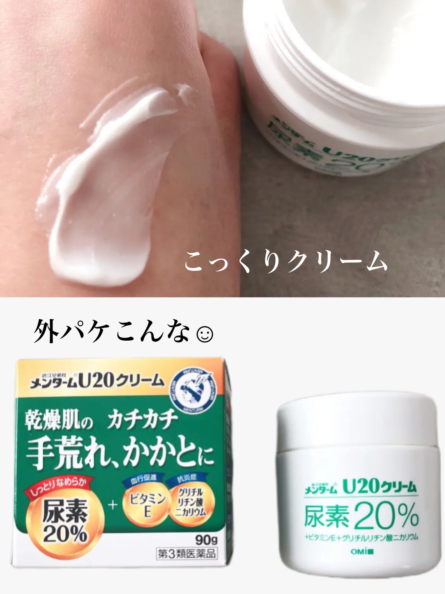 U20クリーム(医薬品)/メンターム/その他を使ったクチコミ(3枚目)