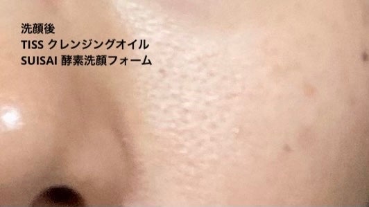 AN on LIPS 「2日ほどサボりました。毛穴がっつり開いてます。2日あけると脂が..」(3枚目)