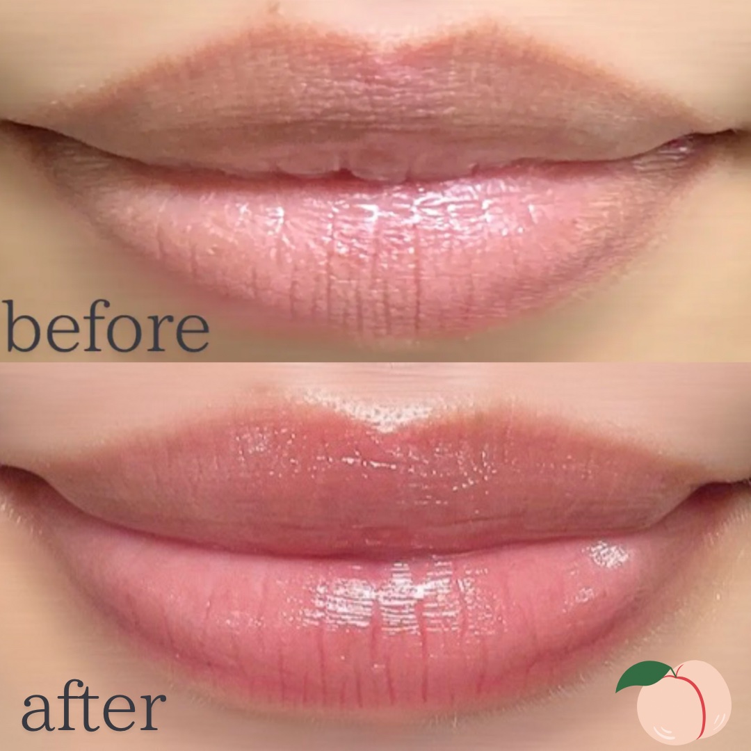 グレイズ ティントリップセラム/LANEIGE/リップ美容液を使ったクチコミ（2枚目）