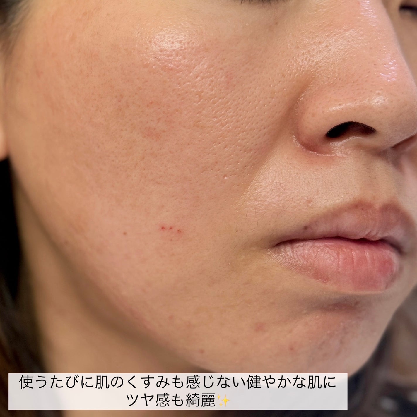 滋陰生(ジャウムセン)アンプル / ブライトニングアンプル/Sulwhasoo/美容液を使ったクチコミ(8枚目)