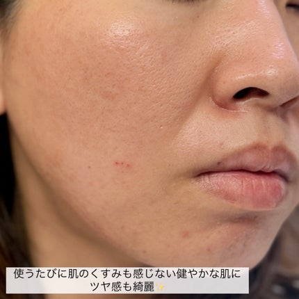 滋陰生(ジャウムセン)アンプル / ブライトニングアンプル/Sulwhasoo/美容液を使ったクチコミ(8枚目)