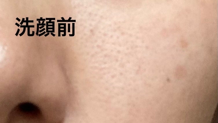 AN on LIPS 「2日ほどサボりました。毛穴がっつり開いてます。2日あけると脂が..」(1枚目)