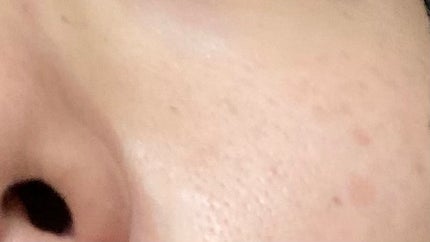 AN on LIPS 「2日ほどサボりました。毛穴がっつり開いてます。2日あけると脂が..」(6枚目)