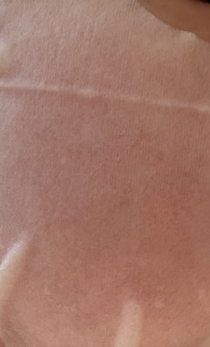 原液美容100マスク VC&レチノール/ONE STONE TWO BIRDS/シートマスク・パックを使ったクチコミ（3枚目）